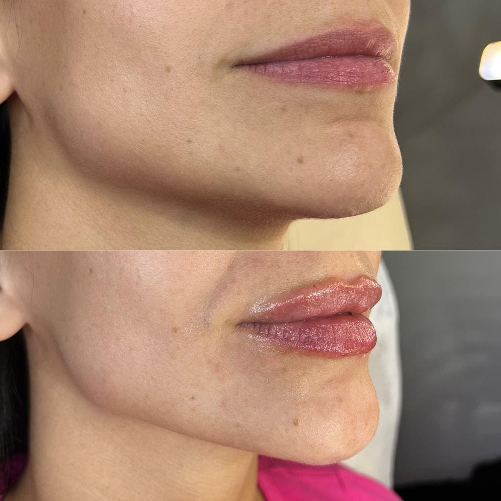 LABIOS